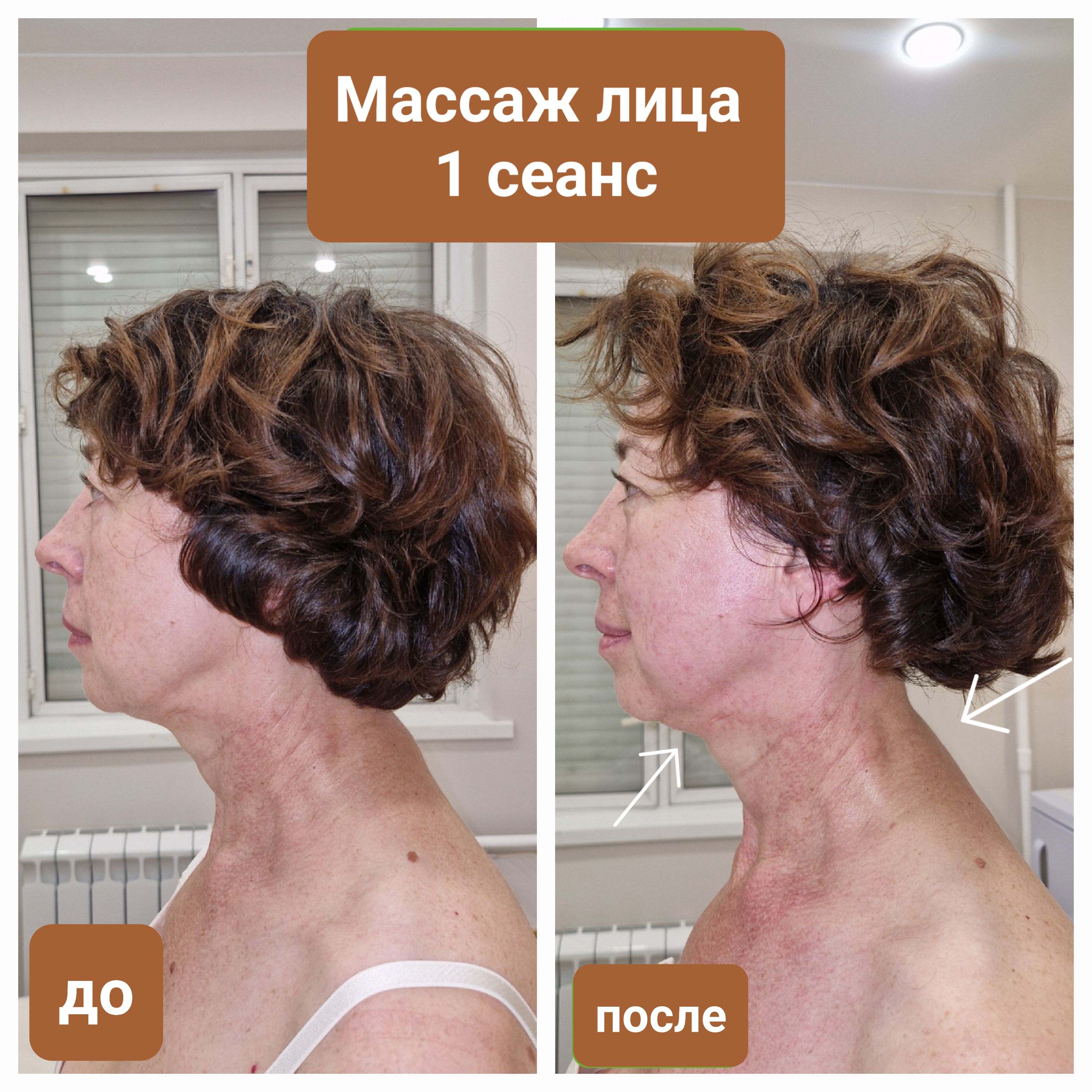 До и после массажа